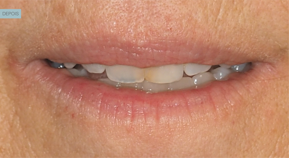 Ortodontia - Caso clínico 3 #2
