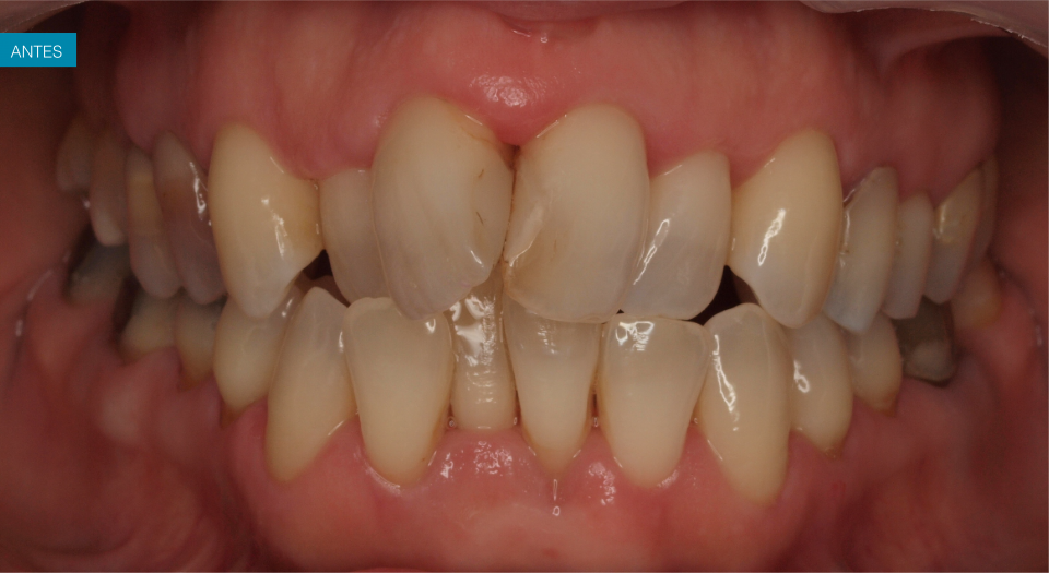 Ortodontia - Caso clínico 3 #3