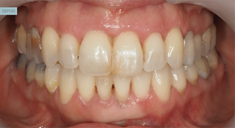 Ortodontia - Caso clínico 3 #1