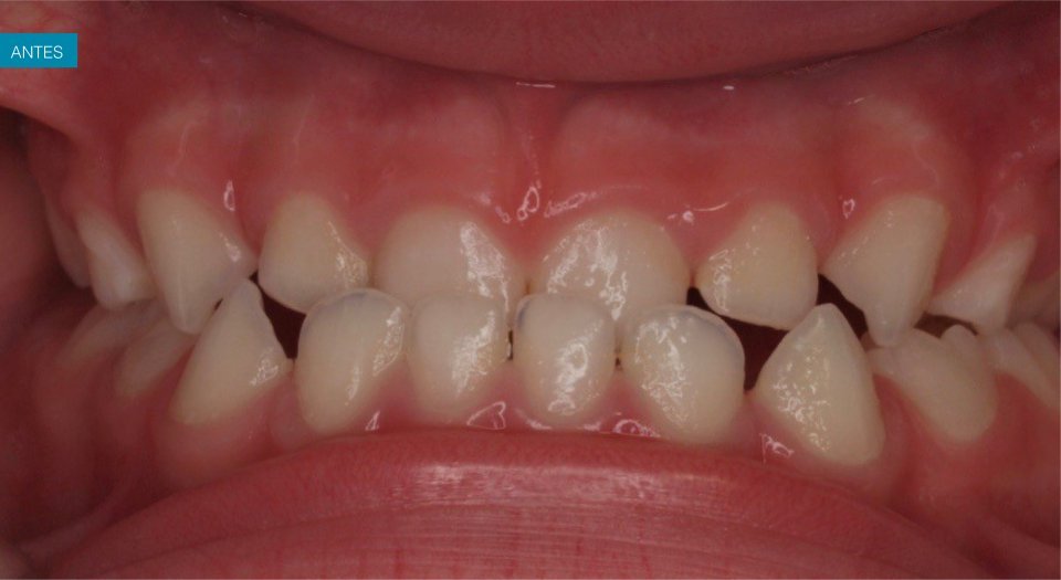 Ortodontia - Caso clínico 6 #1