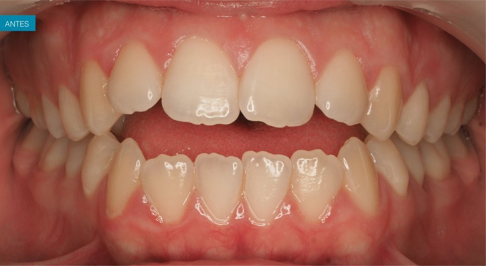 Ortodontia - Caso clínico 1 #2