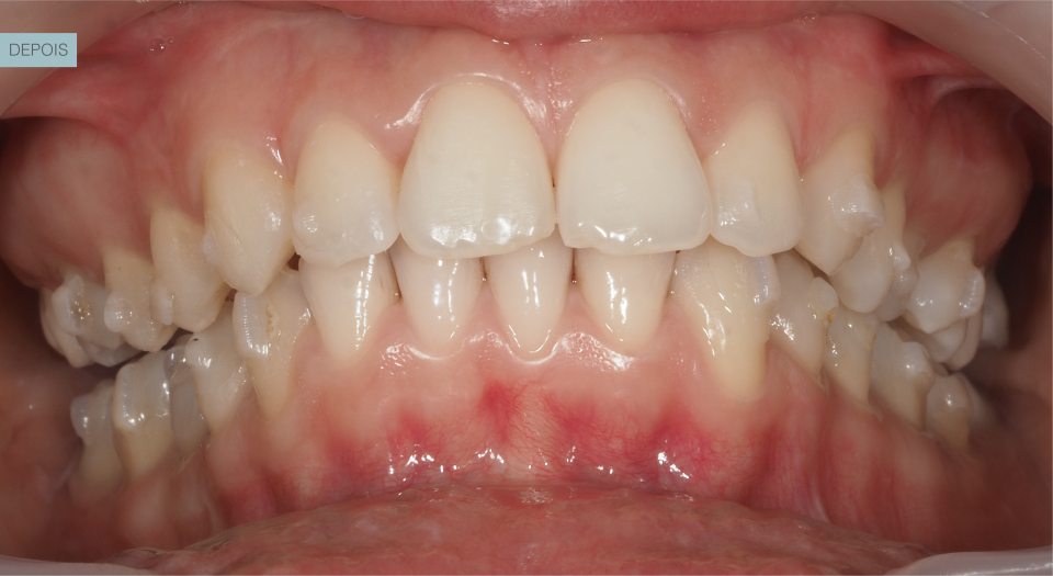 Ortodontia - Caso clínico 4 #1